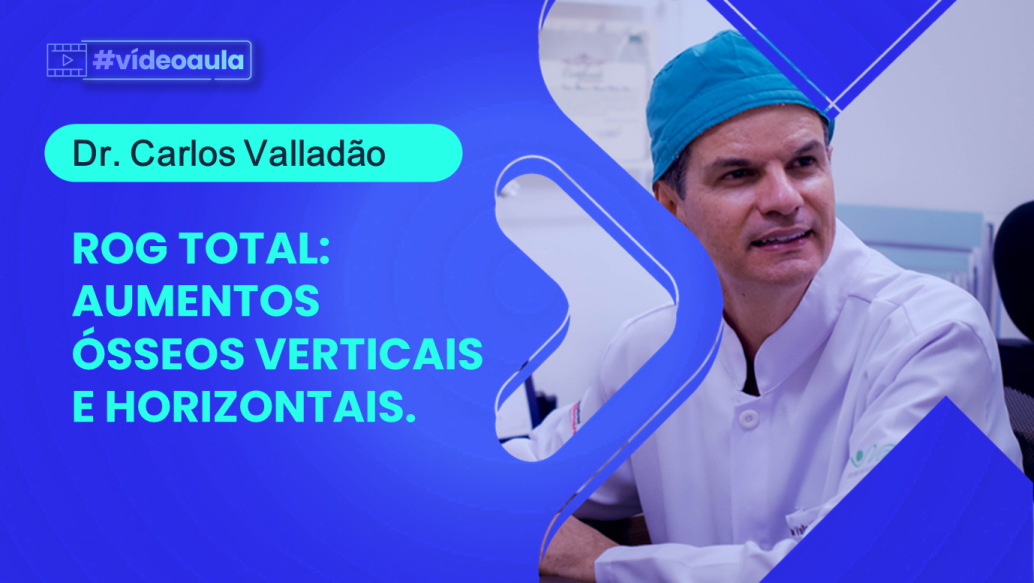 ROG total:  aumentos ósseos verticais e horizontais